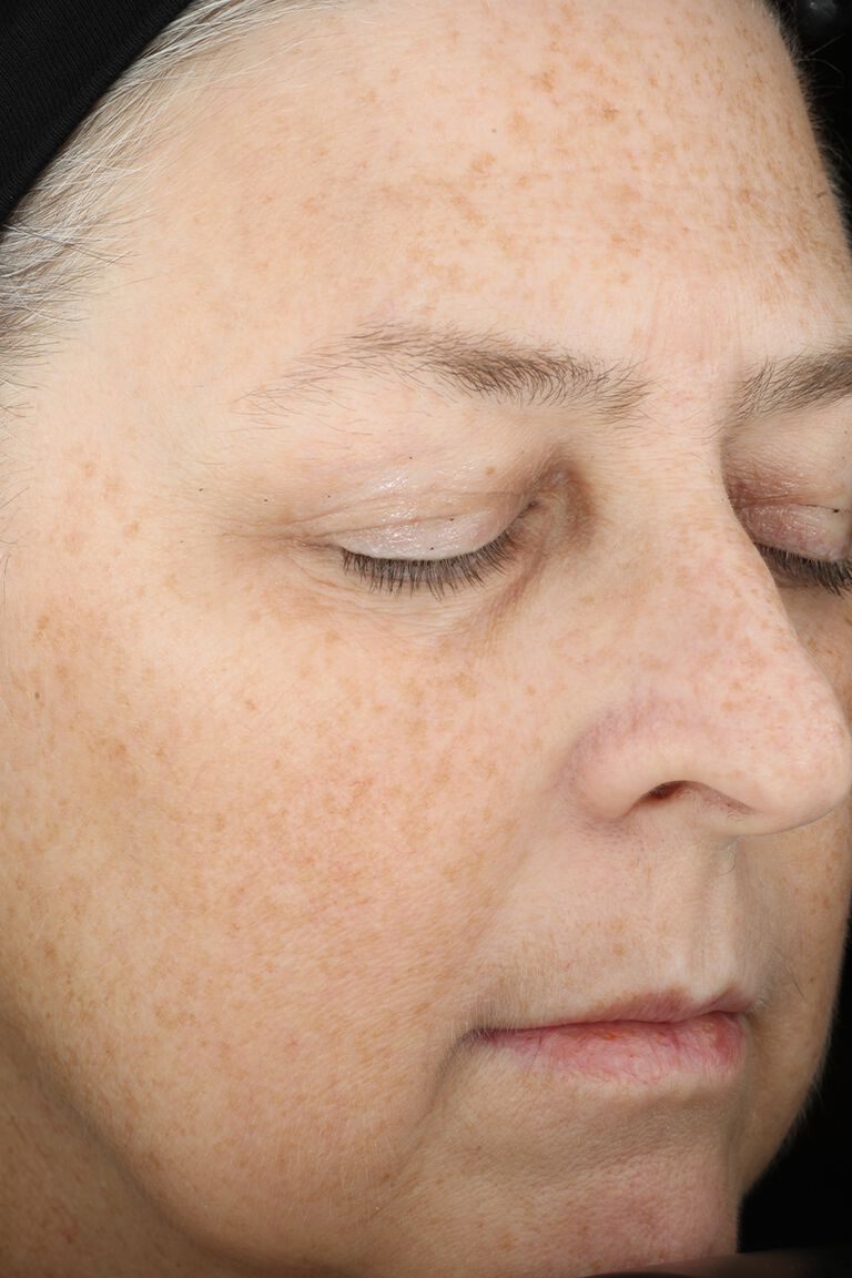 Semana 23 de Mujer A despu&eacute;s de la aplicaci&oacute;n del set Mary Kay TimeWise Miracle