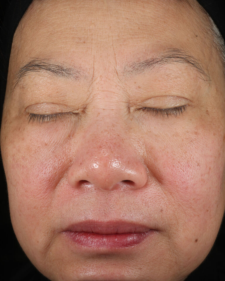 Antes de usar la Loci&oacute;n Facial Regeneradora C+E TimeWise&reg; en la zona de las cejas.