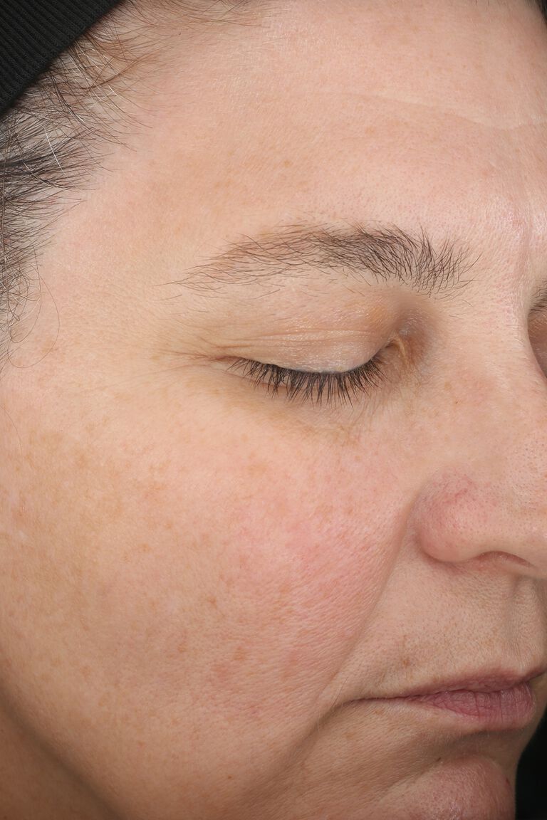 D&iacute;a 1 de Mujer B antes de la aplicaci&oacute;n de set Mary Kay TimeWise Miracle
