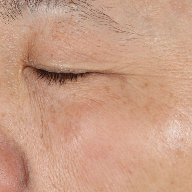 Despu&eacute;s de usar la Loci&oacute;n Facial Regeneradora C+E TimeWise&reg; en la zona de los ojos.
