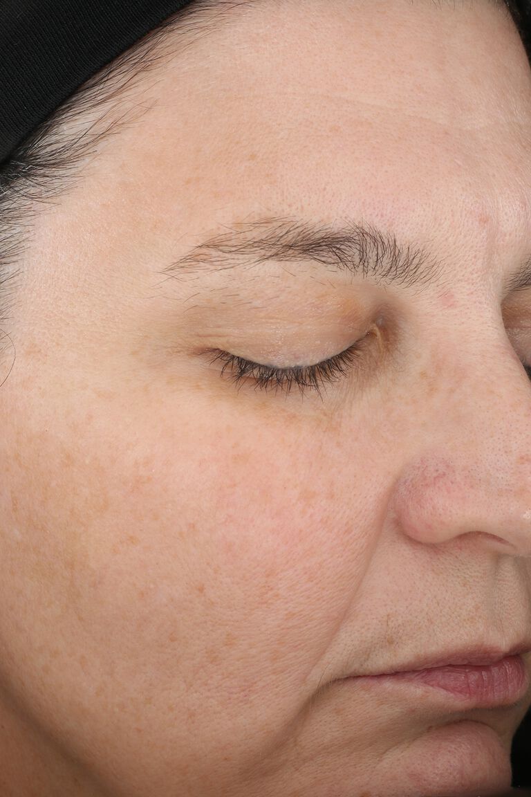 Semana 12 de Mujer B despu&eacute;s de la aplicaci&oacute;n de set Mary Kay TimeWise Miracle