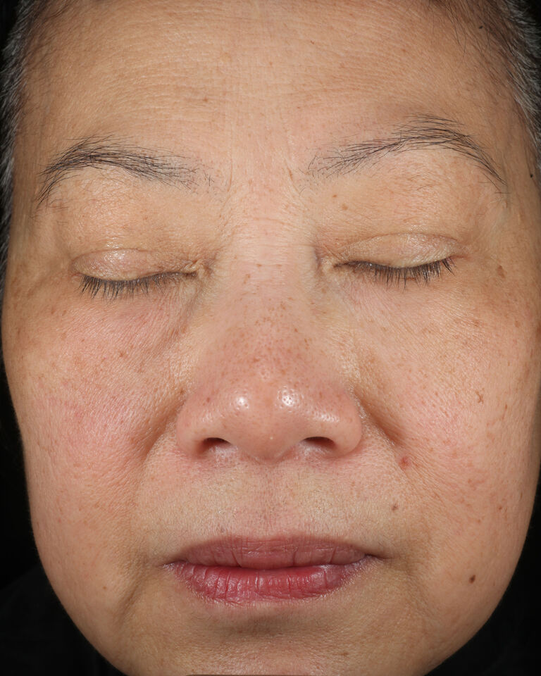 Despu&eacute;s de usar la Loci&oacute;n Facial Regeneradora C+E TimeWise&reg; en la zona de las cejas.